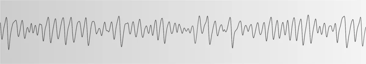 wave form illustration