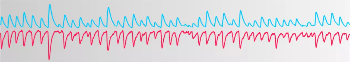 frequency graph illustration