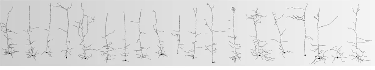 pyrimidal cells lined up in a banner